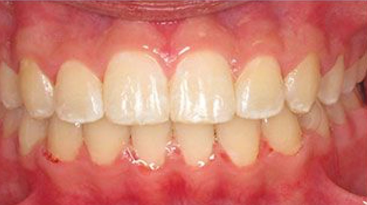 Ryan Cox Orthodontics After photo